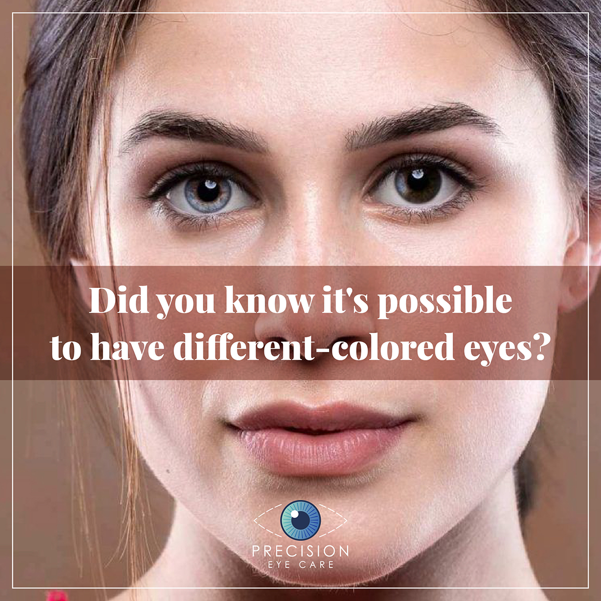 Did you know it’s possible to have different-colored eyes?