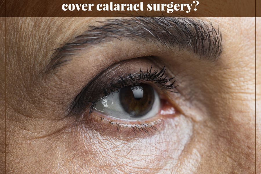 cataract surgery