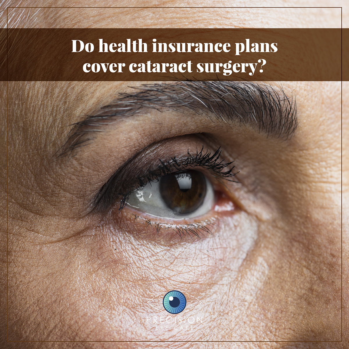 Do health insurance plans cover cataract surgery?