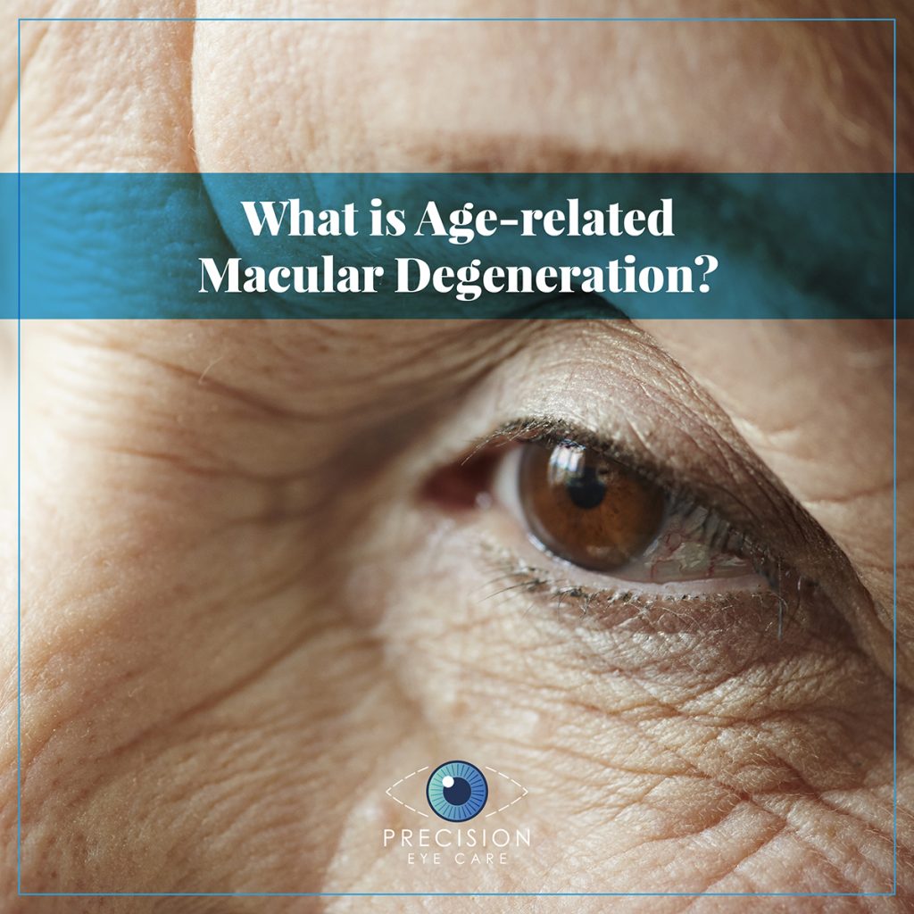 What is Age related Macular Degeneration - Precision Eye - Cataract and ...