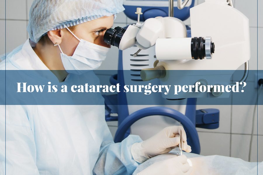 cataract surgery performed
