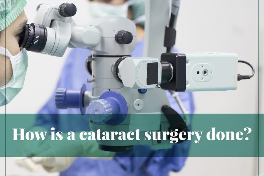 cataract surgery