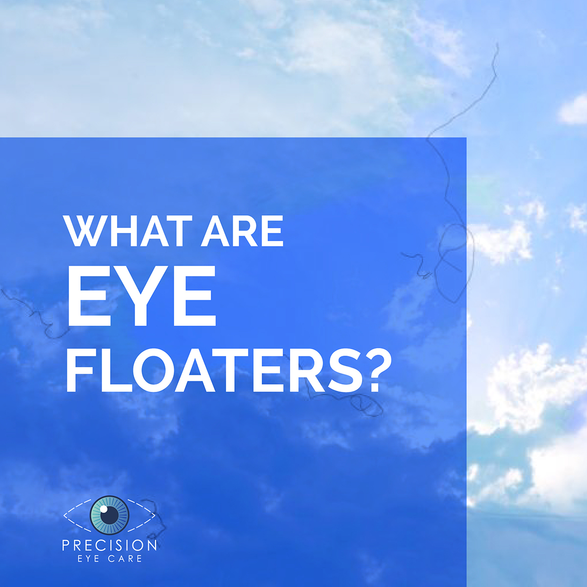 What are Eye Floaters?