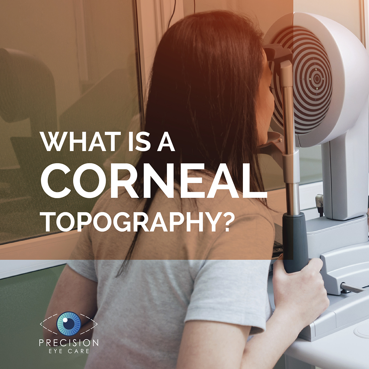 Corneal topography