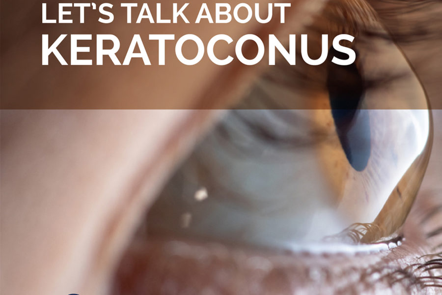 Keratoconus