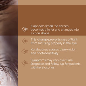 Keratoconus