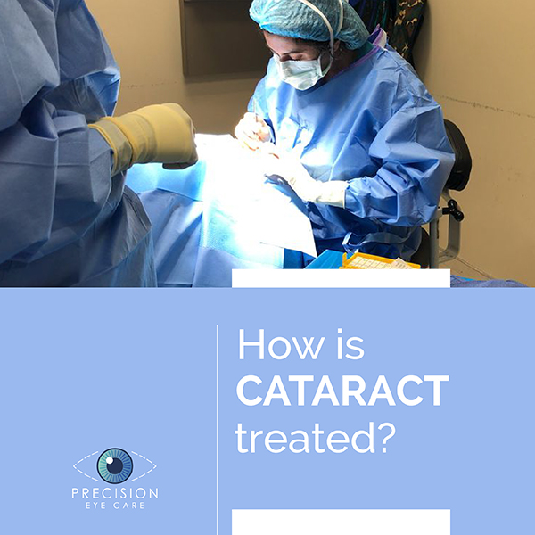 Cataract Surgery Techniques