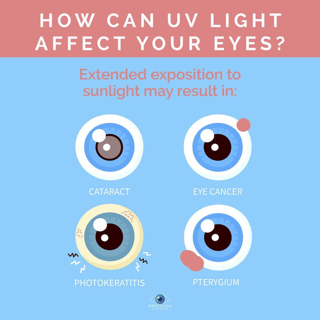 UV Rays - Precision Eye - Cataract and Laser Eye Surgery - Optometrist ...