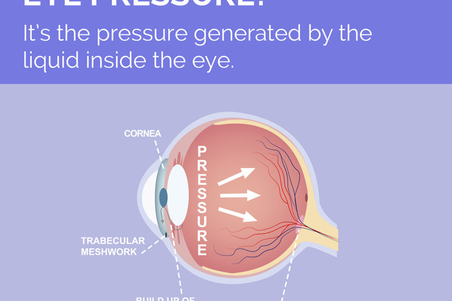 EYE PRESSURE