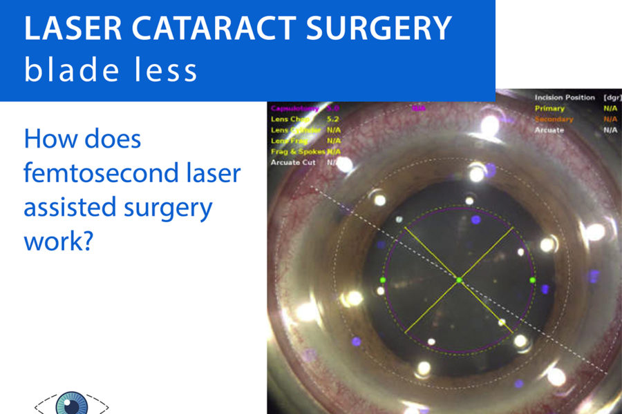 Femtosecond laser