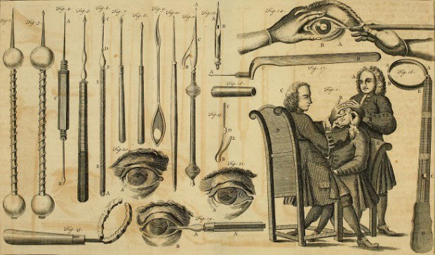 Evolution of Cataract Surgery: From Ancient Practices to Modern Marvels
