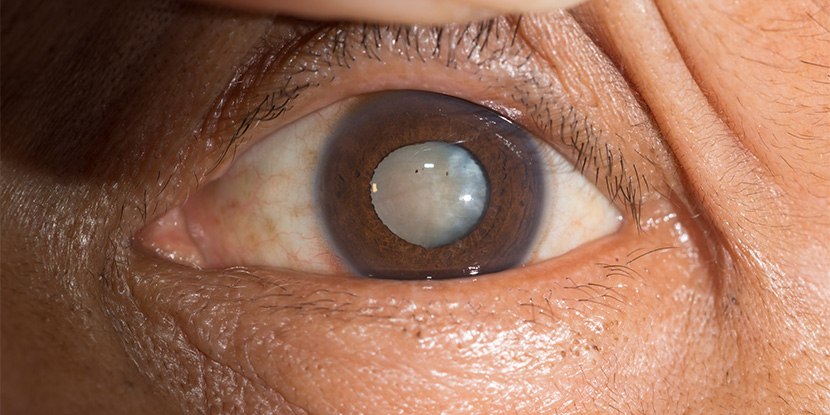 Elevated fall risks in elderly patients with common eye diseases