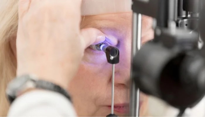 Top Trends in Glaucoma Surgery Evolution: Key Insights